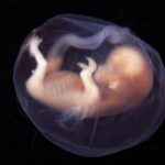 Human embryo and his self-development: study contradicts pro-choice people