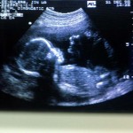 Il neonatologo Bellieni: «il feto si relaziona già prima del parto»