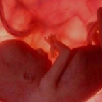 Aborto e dolore fetale, cosa dice la scienza