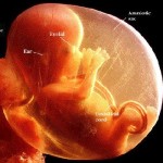 Nebraska: divieto di aborto dopo la 20esima settimana per dolore fetale
