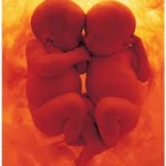 Aborto: già alla 14° settimana i gemelli comunicano fra loro