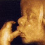 L’ecografia 4D mostra il feto per quello che è: ecco l’ultima arma dei pro-life