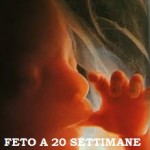 «Che importa se l’aborto termina una vita umana?»
