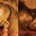 Veronesi si contraddice: «abortire è un evento grave». Perché mai?