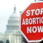 Cinque modi per fermare l’aborto