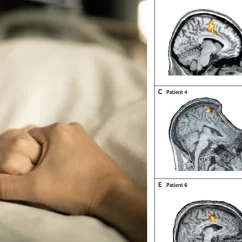 coscienza stati vegetativi eutanasia